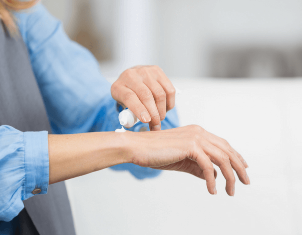 Woman putting cream on her hand to relieve itchiness