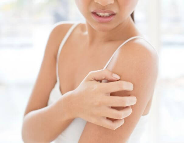 Femme grattant la peau de son bras