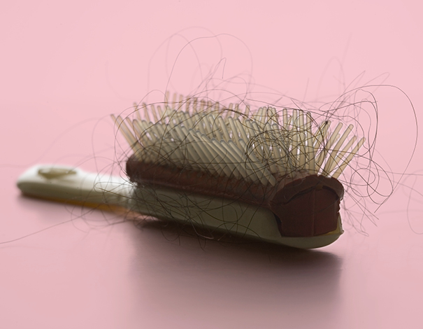 How to prevent hair loss in woman?