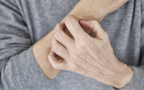 How to prevent and treat dry hands