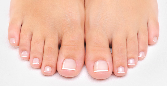 How to prevent and treat ingrown toenails |Uniprix - Uniprix