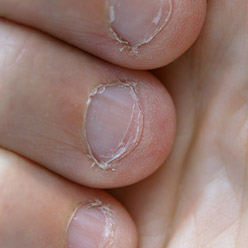 How to stop biting your nails| Uniprix - Uniprix