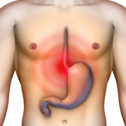 Reflux gastriques : Causes et symptômes | Uniprix - Uniprix