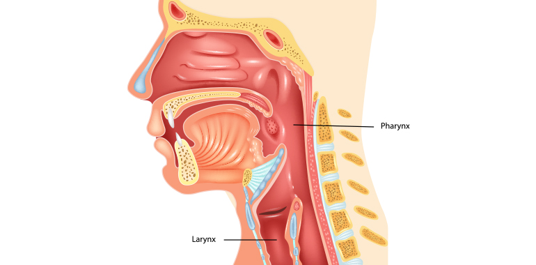 laryngitis diagram